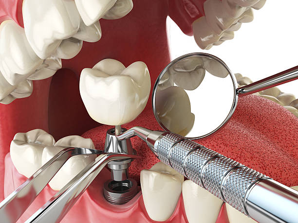 Best After-Hours Emergency Dentist in Cascades, VA